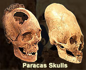 Paracas Skulls