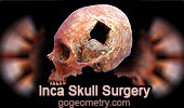 Inca Skull Surgery