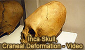 Inca Skull: Cranial Deformation