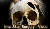 Inca Skull Surgery, Trepanation