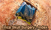 Inca Skull Surgery Index